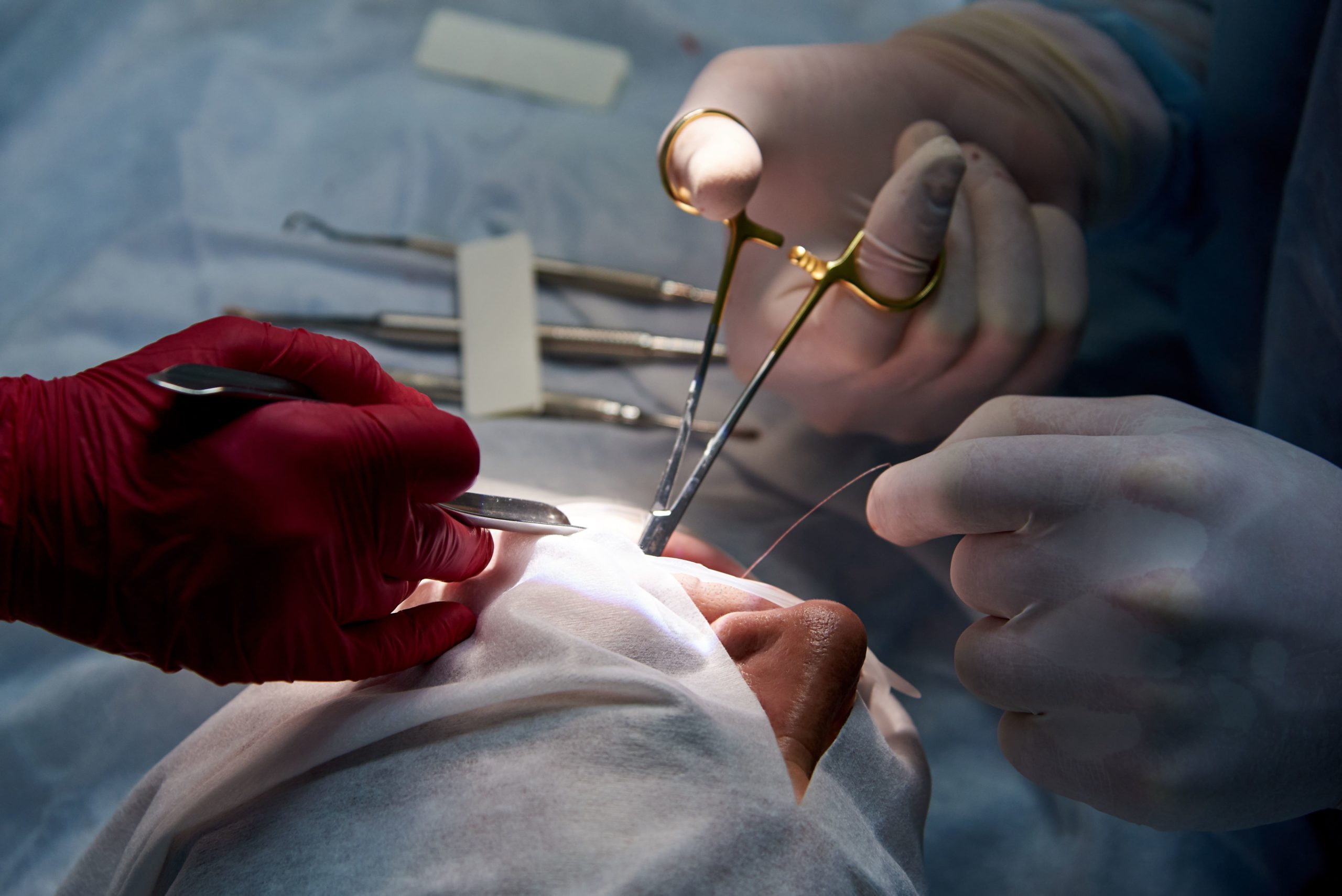 chirurgie parodontala artdentalstudio satu mare